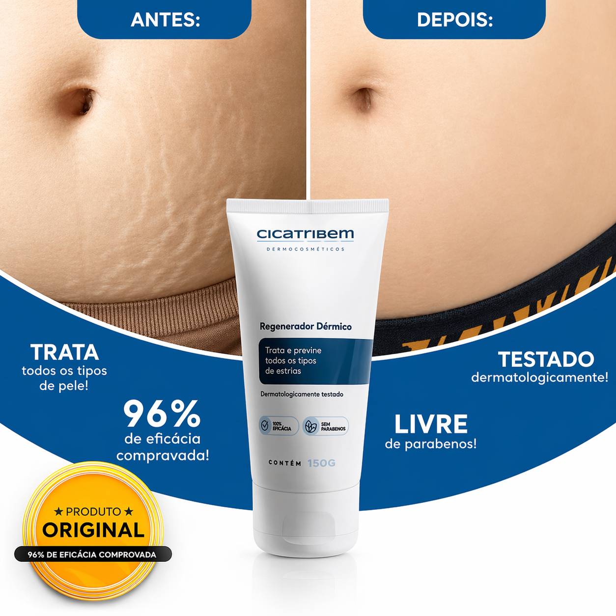 Creme Antiestrias Regenerador Dérmico