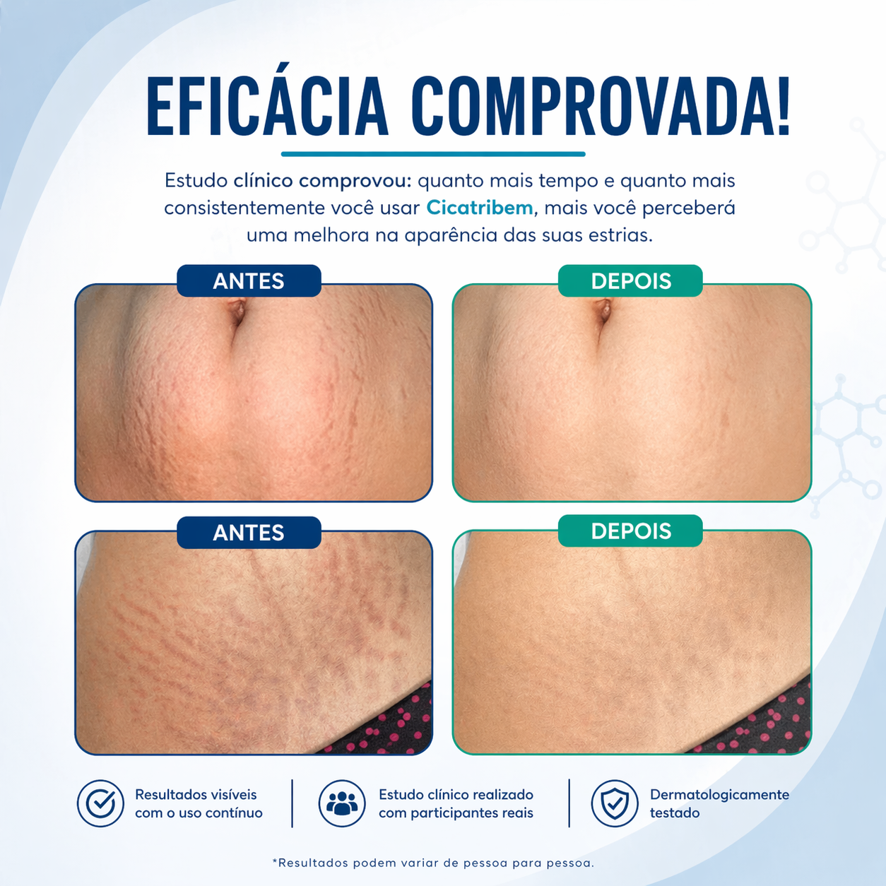 Creme Antiestrias Regenerador Dérmico